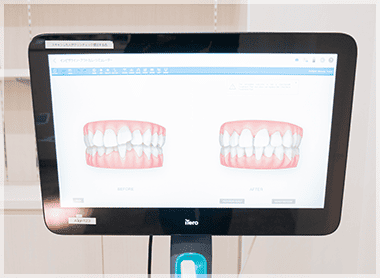 口腔内スキャナー