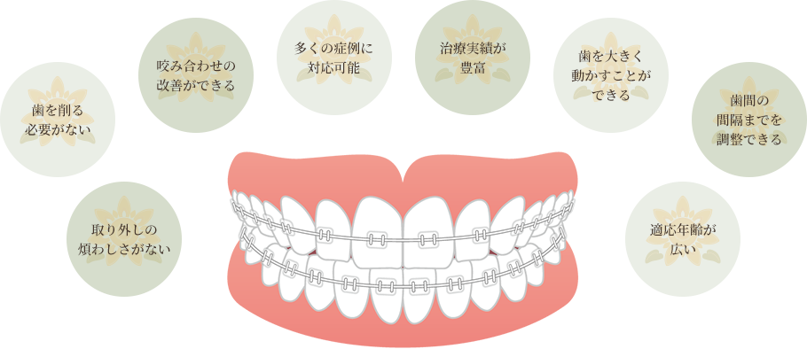 ワイヤー矯正のメリット