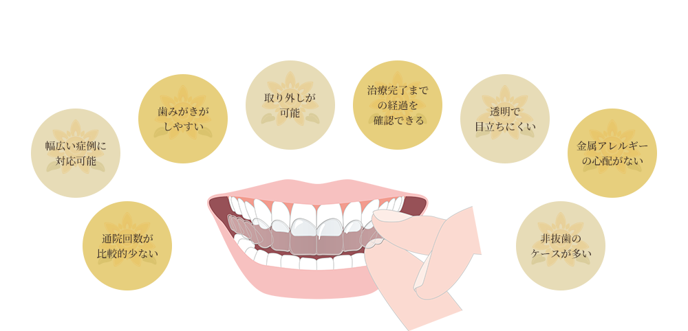 マウスピース矯正のメリット