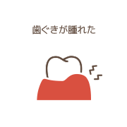 歯ぐきが腫れた