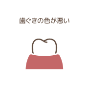 歯ぐきの色が悪い
