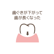 歯ぐきが下がって歯が長くなった