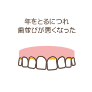 年をとるにつれ歯並びが悪くなった