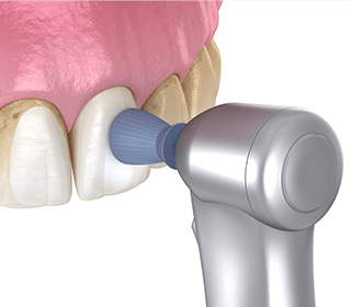 ゴムチップやブラシを使うイメージイラスト